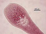 7 - Soro di tetrasporocisti